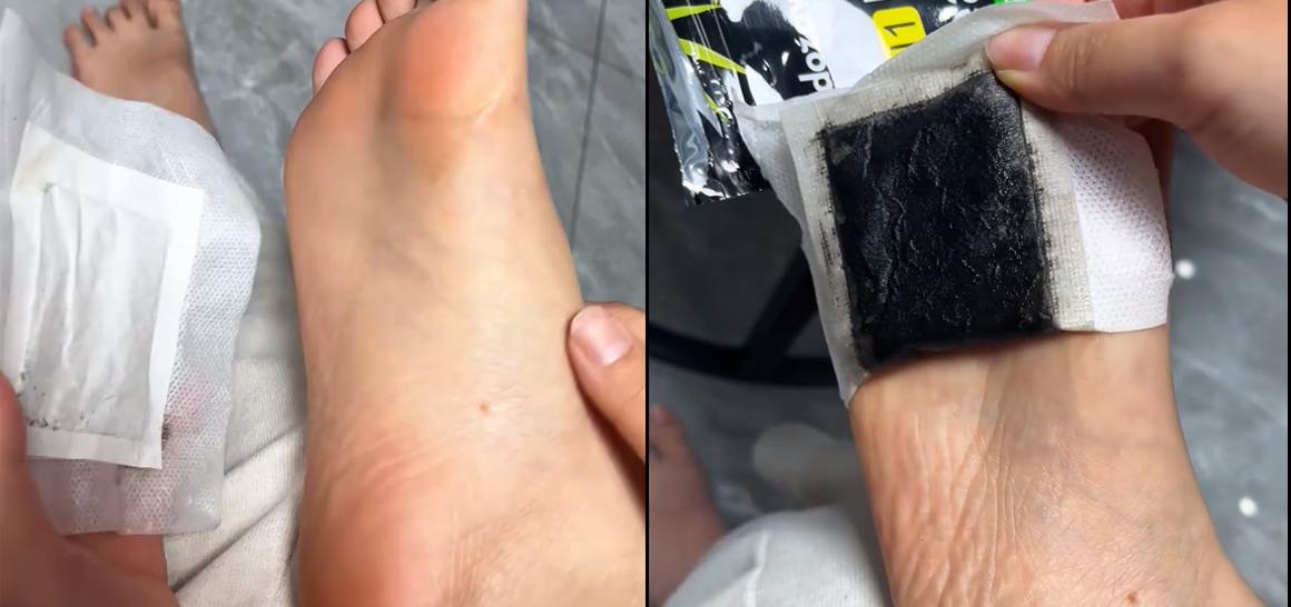 beforeafter
